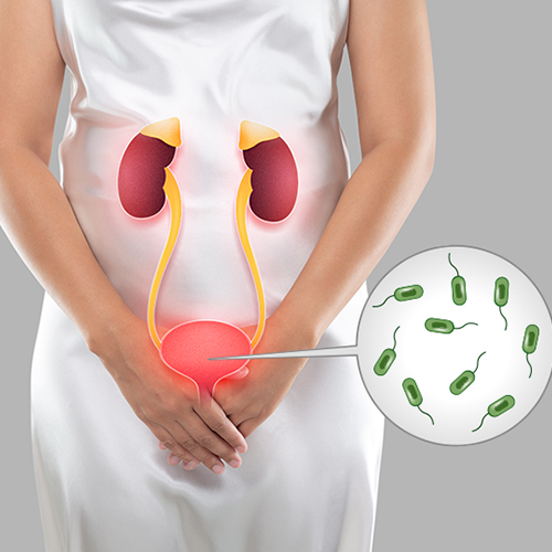 Urinary Tract Infection
