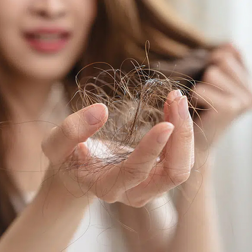 Hair Fall