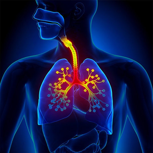 Bronchitis