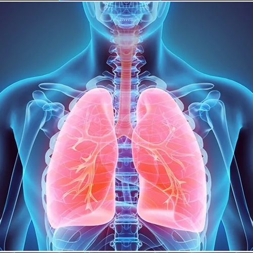 COPD