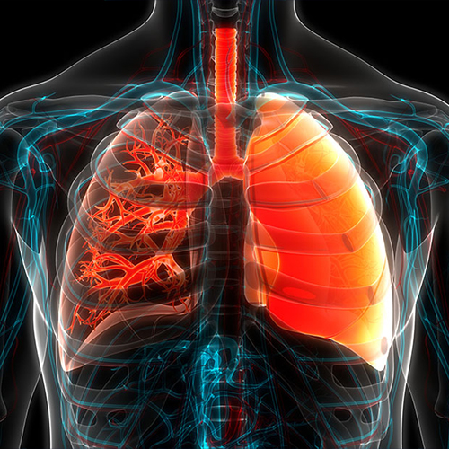 Cystic Fibrosis
